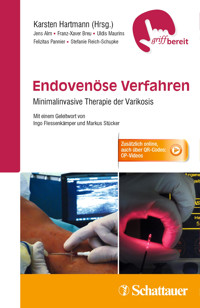 Endovenöse Verfahren - Jens Alm - E-Book
