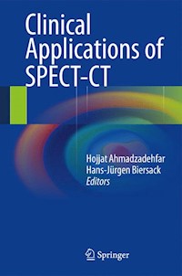 Clinical Applications of SPECT-CT - - E-Book