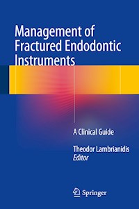Management of Fractured Endodontic Instruments -  - E-Book