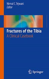 Fractures of the Tibia -  - E-Book