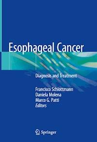Esophageal Cancer -  - E-Book