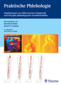 Praktische Phlebologie - Eberhard Rabe - E-Book