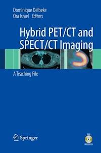 Hybrid PET/CT and SPECT/CT Imaging -  - E-Book