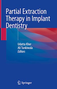 Partial Extraction Therapy in Implant Dentistry - - E-Book