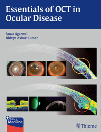 Essentials of OCT in Ocular Disease -  - E-Book