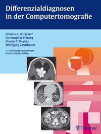 Differenzialdiagnosen in der Computertomografie - Francis A. Burgener - E-Book