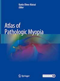 Atlas of Pathologic Myopia -  - E-Book