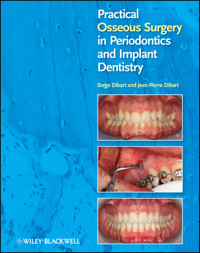 Practical Osseous Surgery in Periodontics and Implant Dentistry - Serge Dibart - E-Book