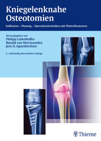Kniegelenknahe Osteotomien - - E-Book