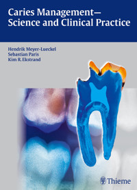 Caries Management - Science and Clinical Practice -  - E-Book