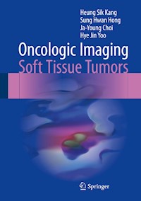 Oncologic Imaging: Soft Tissue Tumors - Heung Sik Kang - E-Book