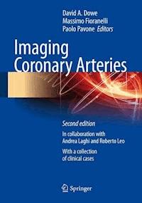 Imaging Coronary Arteries - - E-Book