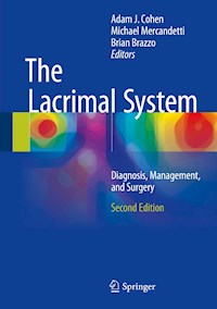 The Lacrimal System -  - E-Book