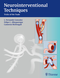Neurointerventional Techniques - Fernando Gonzalez - E-Book
