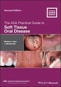 The ADA Practical Guide to Soft Tissue Oral Disease - Michael A. Kahn - E-Book