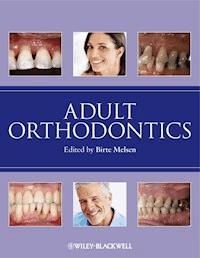 Adult Orthodontics - - E-Book