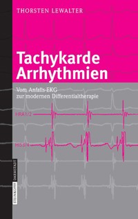 Tachykarde Arrhythmien - Thorsten Lewalter - E-Book