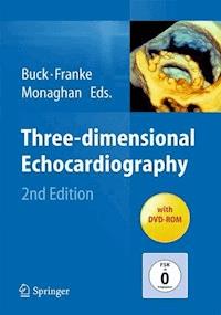 Three-dimensional Echocardiography -  - E-Book