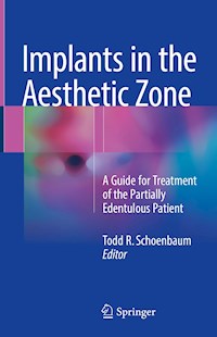 Implants in the Aesthetic Zone -  - E-Book