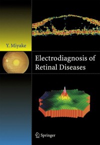 Electrodiagnosis of Retinal Disease - Yozo Miyake - E-Book