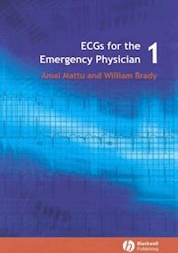 ECGs for the Emergency Physician 1 - Amal Mattu - E-Book