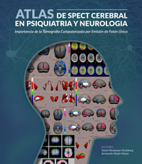 Atlas de spect cerebral en psiquiatria y neurología - aa.vv - E-Book