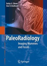 Paleoradiology - R.K. Chhem - E-Book