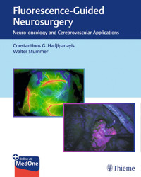 Fluorescence-Guided Neurosurgery - Constantinos G. Hadjipanayis - E-Book