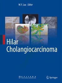 Hilar Cholangiocarcinoma -  - E-Book