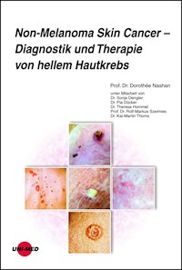 Non-Melanoma Skin Cancer - Diagnostik und Therapie von hellem Hautkrebs - Dorothée Nashan - E-Book