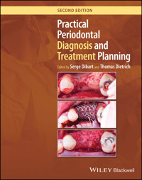 Practical Periodontal Diagnosis and Treatment Planning -  - E-Book