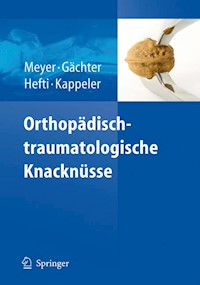 Orthopädisch-traumatologische Knacknüsse -  - E-Book