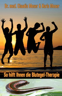 So hilft ihnen die Blutegeltherapie - Dr. med. Claudia Moser - E-Book