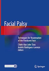 Facial Palsy -  - E-Book