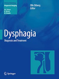 Dysphagia -  - E-Book
