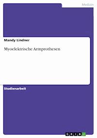 Myoelektrische Armprothesen - Mandy Lindner - E-Book
