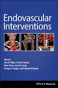 Endovascular Interventions -  - E-Book