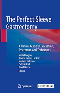 The Perfect Sleeve Gastrectomy -  - E-Book