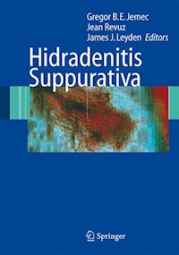Hidradenitis Suppurativa -  - E-Book