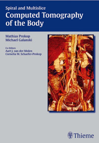Spiral and Multislice Computed Tomography of the Body - - E-Book