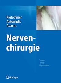 Nervenchirurgie -  - E-Book