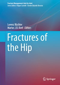 Fractures of the Hip - - E-Book