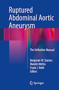 Ruptured Abdominal Aortic Aneurysm -  - E-Book
