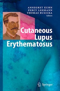 Cutaneous Lupus Erythematosus -  - E-Book