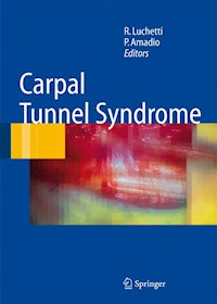 Carpal Tunnel Syndrome -  - E-Book