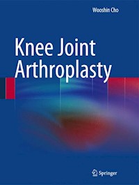 Knee Joint Arthroplasty - Wooshin Cho - E-Book