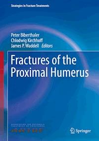 Fractures of the Proximal Humerus -  - E-Book