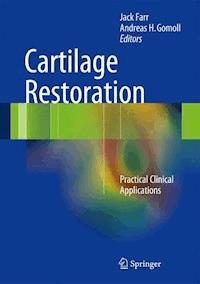 Cartilage Restoration -  - E-Book
