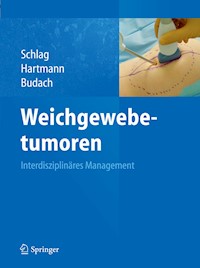 Weichgewebetumoren -  - E-Book
