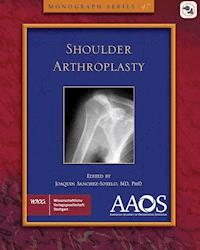 AAOS Shoulder Arthroplasty - Joaquin Sanchez-Sotelo - E-Book